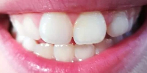 Clínica Dental Cristaldent Dentista en Valdemoro